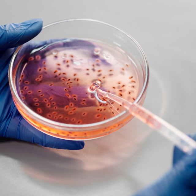 gloved hands holding petri dish