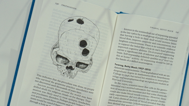 Neuropedia skull illustration closeup