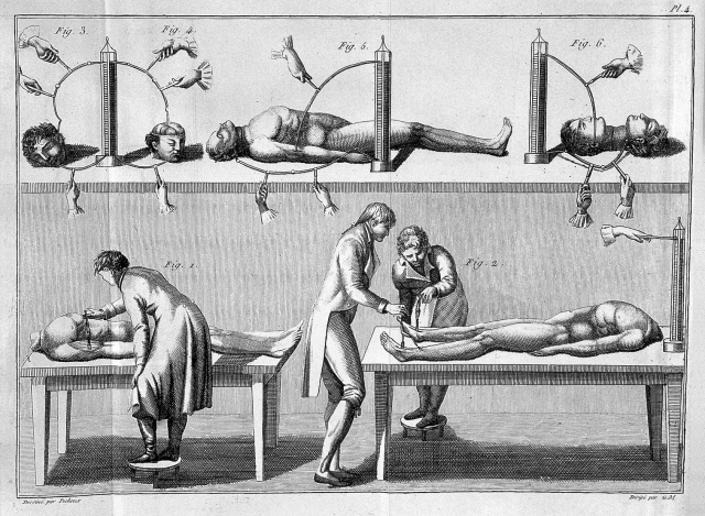 Ink drawing of medical workers reanimating corpses with electricity